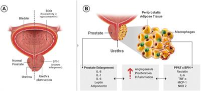 The Role of Periprostatic Adipose Tissue on Prostate Function in Vascular-Related Disorders